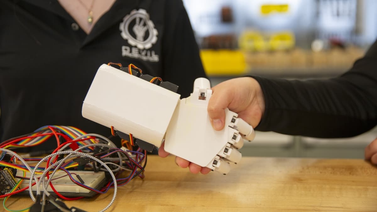 Child with prosthetic arm